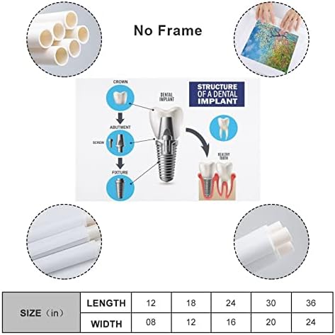 BLUDUG zubný implantát Zubná starostlivosť plagát Zubná klinika plagát plátno maľba plagáty a výtlačky Nástenné